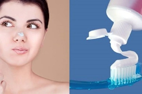 Phân loại các phương pháp trị mụn đầu đen tại nhà phổ biến