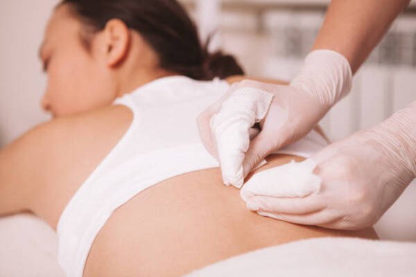 Quy trình chăm sóc và nặn mụn lưng chuyên sâu tại các cơ sở spa uy tín