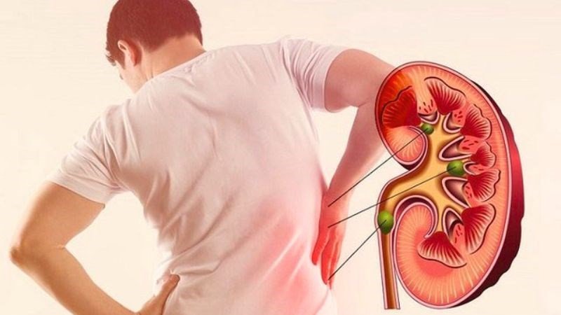 Ăn quá nhiều cà chua có thể ảnh hưởng đến thận