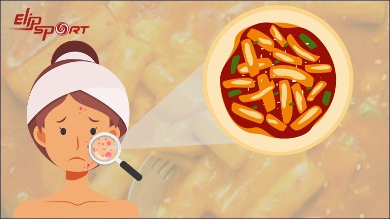 Ăn Tokbokki có thể nổi mụn, đặc biệt là với những người có làn da nhạy cảm