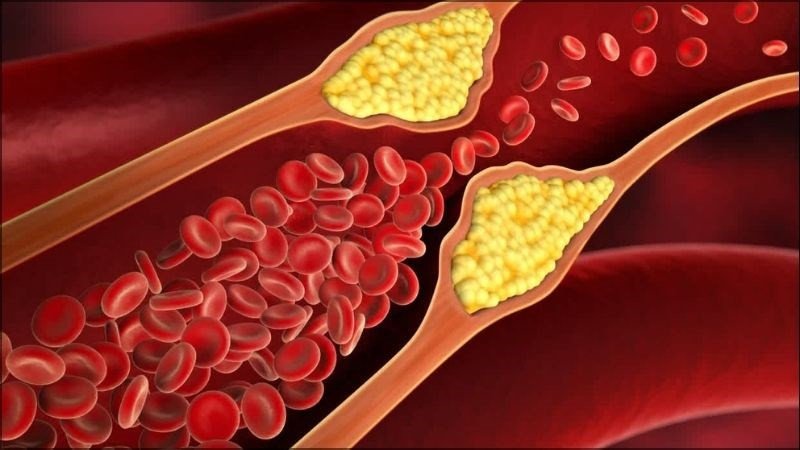 Cà chua giúp giảm cholesterol xấu