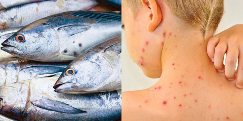 Dấu hiệu dị ứng khi ăn cá ngừ cần lưu ý