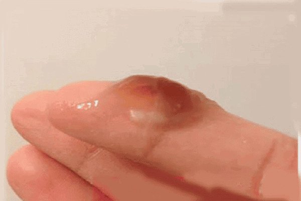 Dấu hiệu và biểu hiện của tinh dịch màu nâu, bước đầu trong cách chữa tinh trùng màu nâu