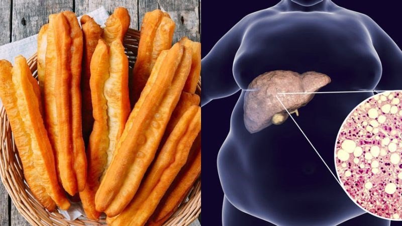Đĩa bánh quẩy chiên giòn rụm, minh họa món ăn cần được cân nhắc cho người có vấn đề về cân nặng hoặc mỡ máu