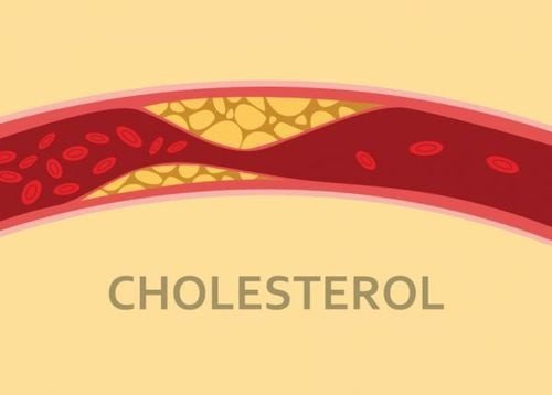 Hình ảnh minh họa về cholesterol và sức khỏe tim mạch