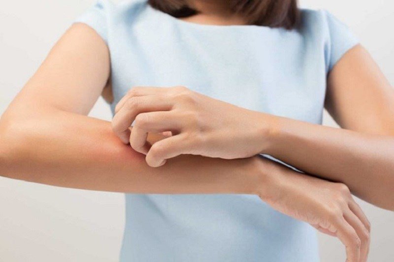 Lưu ý cho người dị ứng với nước dừa