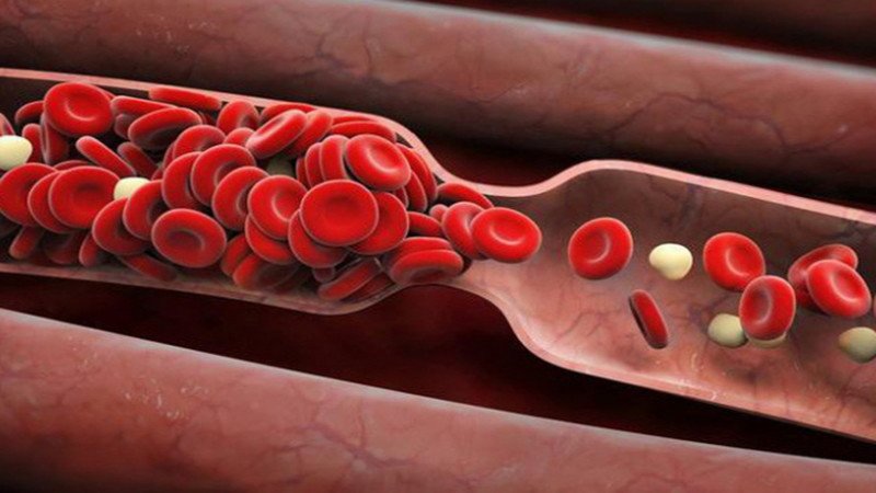 Mô tả công dụng chống đông máu của mộc nhĩ