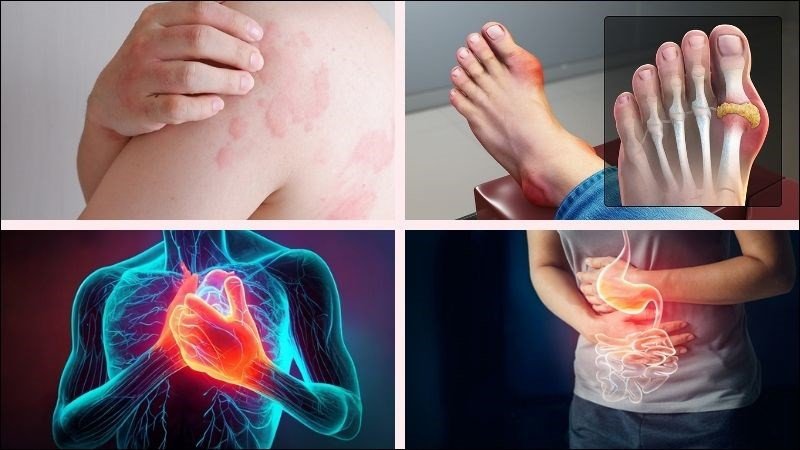Một số đối tượng cần hạn chế ăn chân gà để đảm bảo sức khỏe