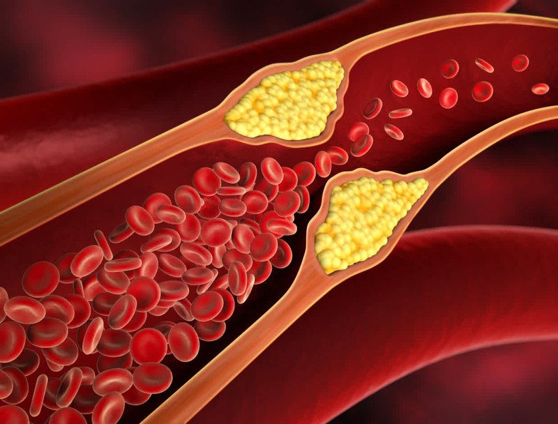 Nấm đùi gà hỗ trợ giảm cholesterol