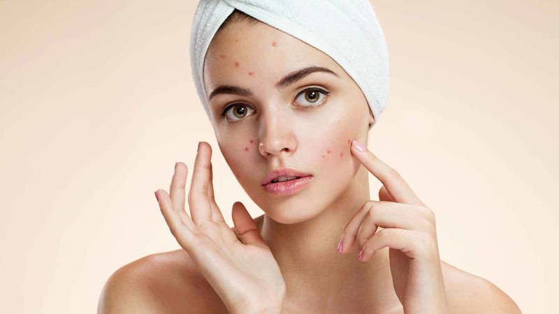 Người bị mụn trứng cá nên cân nhắc lượng bánh trung thu thập cẩm tiêu thụ