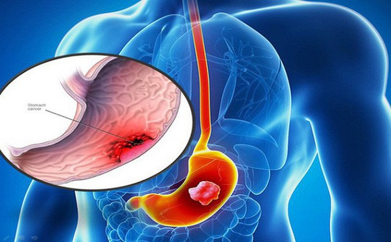Người phụ nữ uống nước lá tía tô giúp duy trì vóc dáng thon gọn