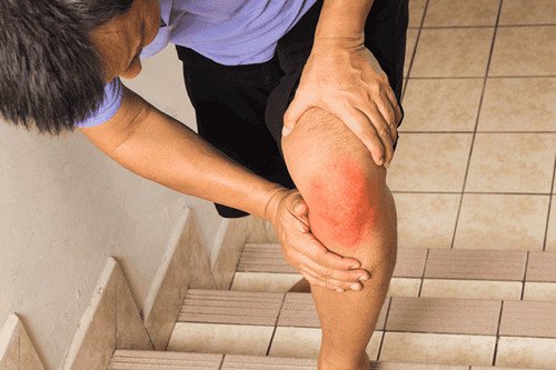 Những lưu ý an toàn khi leo cầu thang giảm cân để đốt cháy calo hiệu quả.