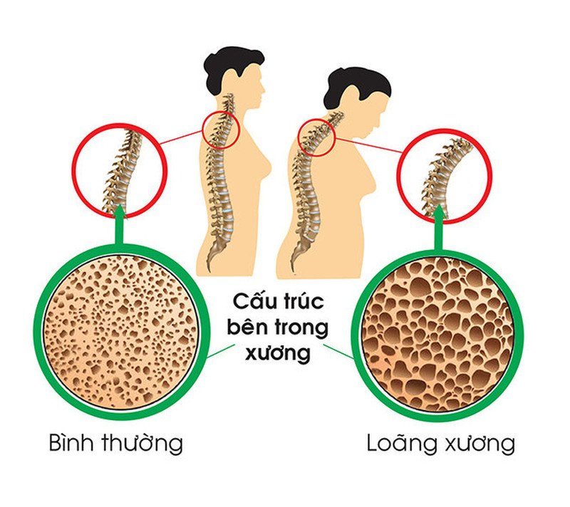 Rau cải ngọt giúp tăng cường sức khỏe xương khớp, đặc biệt cho người lớn tuổi