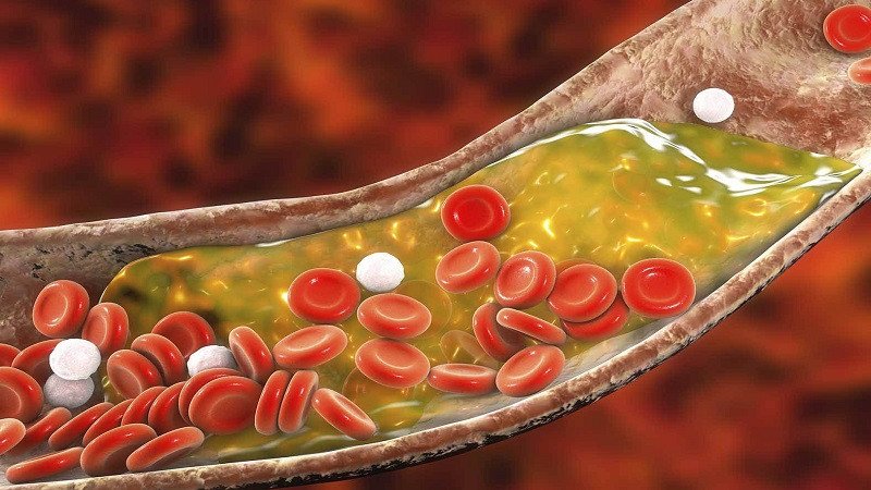 Rau càng cua hỗ trợ giảm cholesterol trong máu