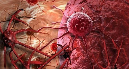 Súp lơ xanh luộc giúp ngăn ngừa ung thư nhờ hợp chất sulforaphane