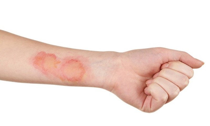Tác hại của việc ăn quá nhiều lòng lợn nhồi tiết