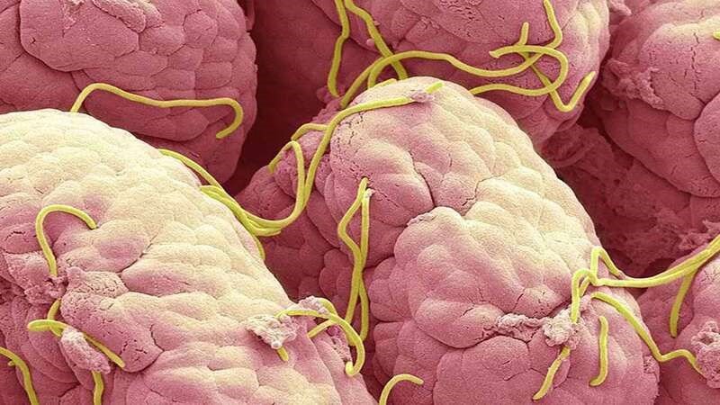 Thịt bằm cần được nấu chín kỹ lưỡng để loại bỏ nguy cơ nhiễm ký sinh trùng và các vi khuẩn gây hại.