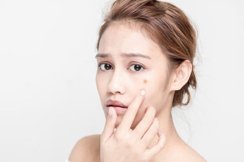 Thịt bò khô có thể tác động đến quá trình lành da mụn