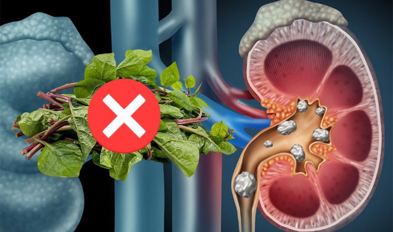 Thực phẩm cần lưu ý khi có vấn đề về tiêu hóa