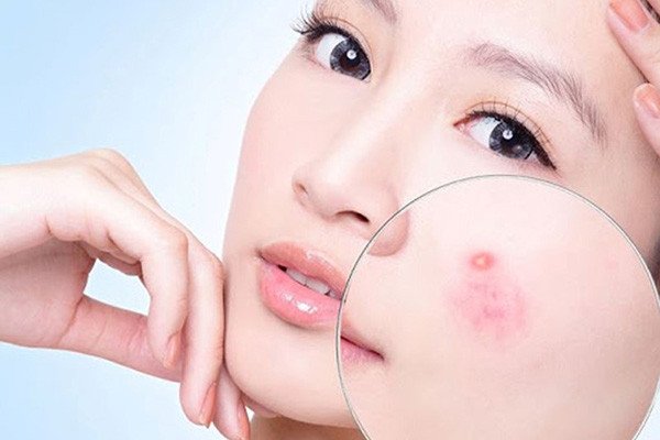 Uống sâm bông cúc giúp đẹp da