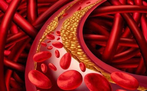 mối liên hệ giữa chất béo bão hòa, cholesterol và 1g fat bằng bao nhiêu calo